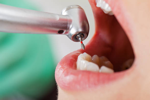 Best Knocked-Out Tooth Emergency  in Eagan, MN